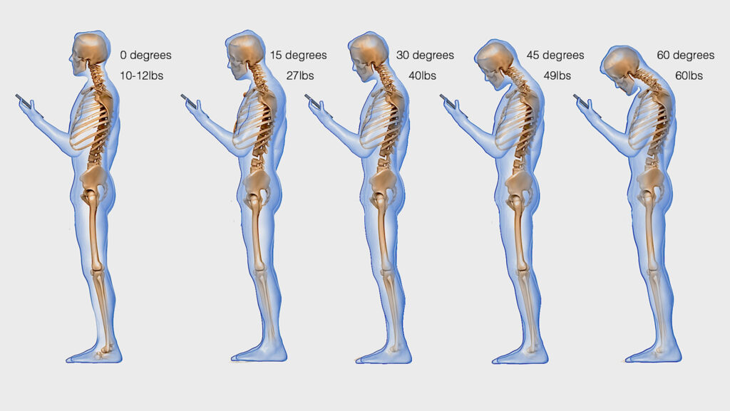 Texting spine